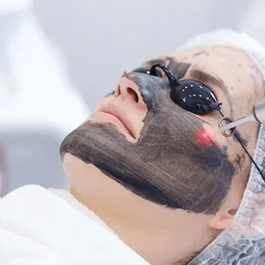 Black Peel
