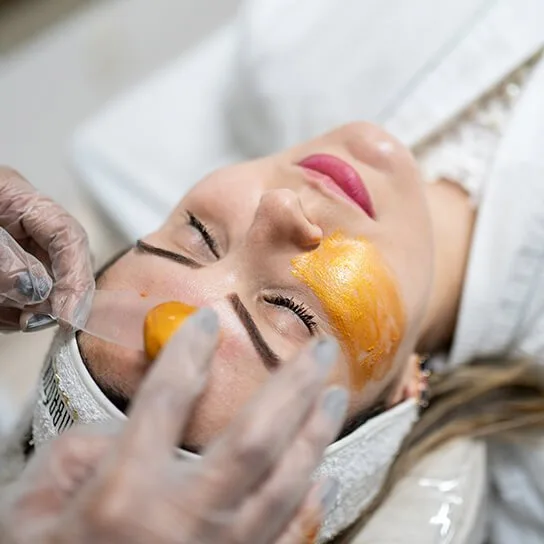 Peeling de Fenol